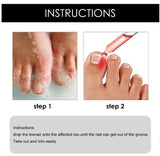 Ingrown Toenail Drops 60 ml Pack of 2 Beauty & Personal Care